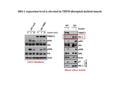 E3 ligase TRIM72 negatively regulates myogenesis by IRS-1 ...