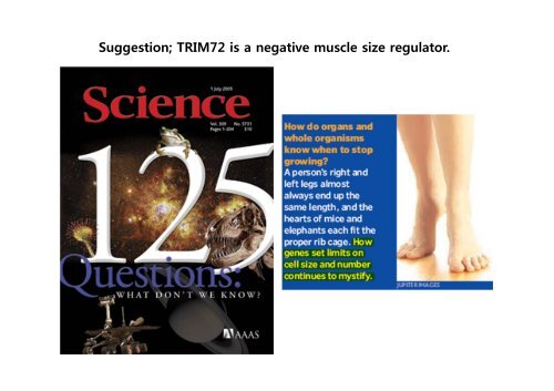 E3 ligase TRIM72 negatively regulates myogenesis by IRS-1 ...