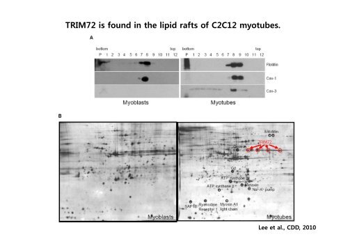 E3 ligase TRIM72 negatively regulates myogenesis by IRS-1 ...