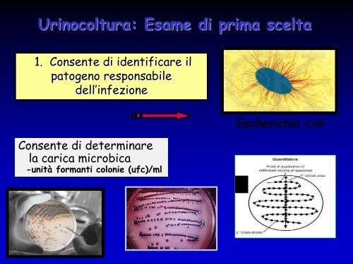 Infezioni delle vie urinarie