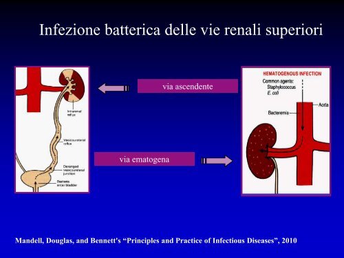 Infezioni delle vie urinarie