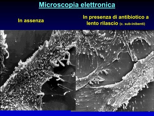 Infezioni delle vie urinarie