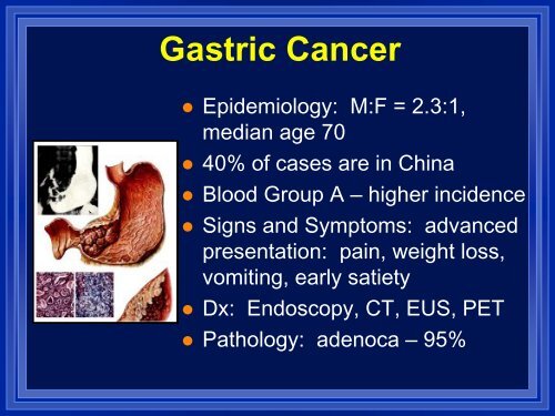 Esophageal And Gastric Cancer