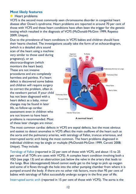 22q11.2 deletions syndrome (Velo-Cardio-Facial Syndrome) FTNW