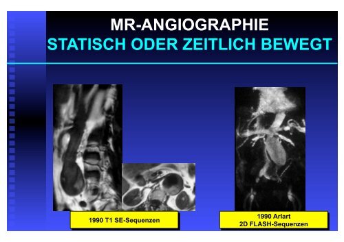 Statisch oder zeitlich bewegt?