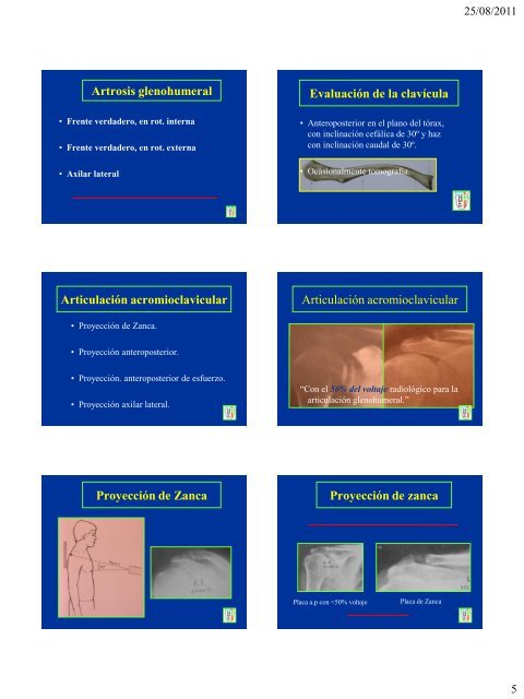 Radiologia de la cintura escapular