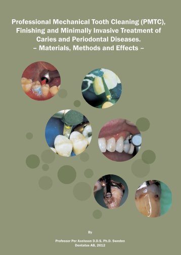 Read the book here online - Dentatus