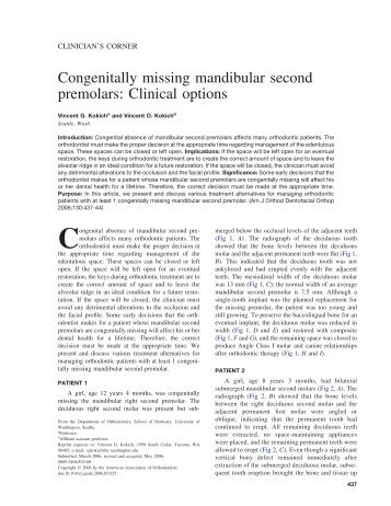 Congenitally missing mandibular second premolars ... - DentalXP