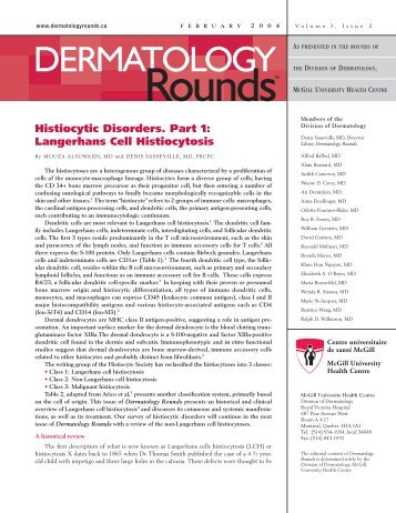 Histiocytic Disorders. Part 1: Langerhans Cell Histiocytosis