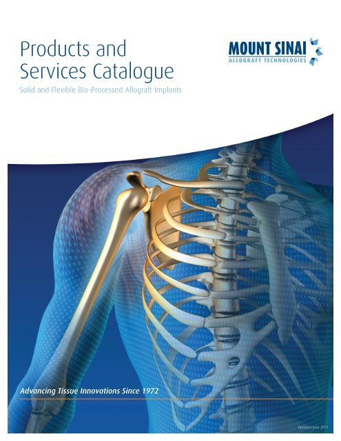 Allograft Products and Services Catalogue - Mount Sinai Hospital
