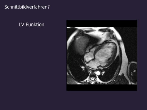 Die Rolle der Schnittbildgebung aus der Sicht der Kardiologie