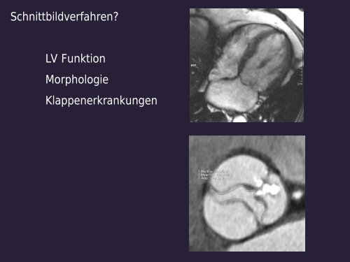 Die Rolle der Schnittbildgebung aus der Sicht der Kardiologie