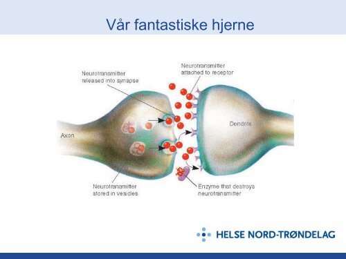 Epilepsi og kramper hos barn.