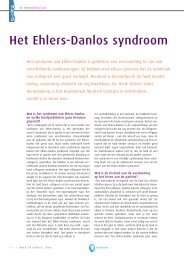 Het Ehlers-Danlos syndroom - Huid Magazine