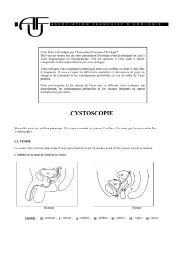 CYSTOSCOPIE - Urofrance