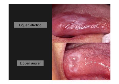 Curso Diagnóstico precoz del cáncer oral.