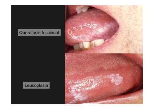 Curso Diagnóstico precoz del cáncer oral.