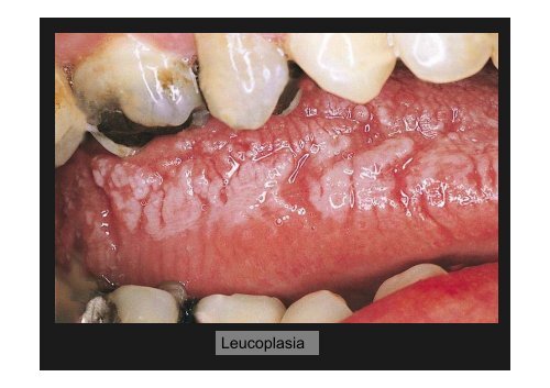 Curso Diagnóstico precoz del cáncer oral.