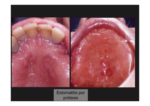 Curso Diagnóstico precoz del cáncer oral.