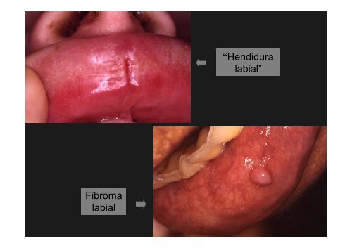 Curso Diagnóstico precoz del cáncer oral.