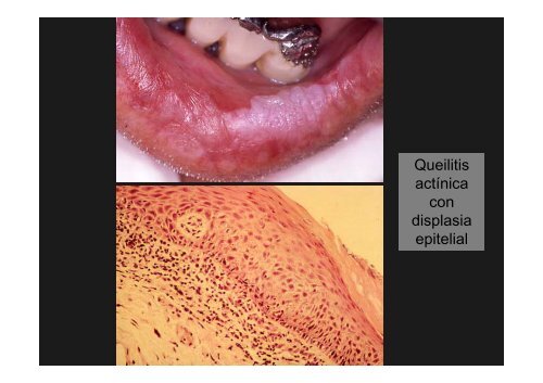 Curso Diagnóstico precoz del cáncer oral.