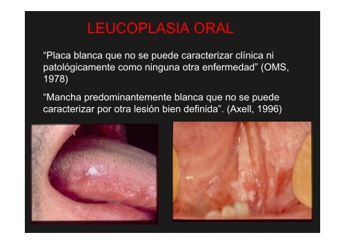 Curso Diagnóstico precoz del cáncer oral.