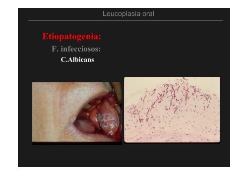 Curso Diagnóstico precoz del cáncer oral.