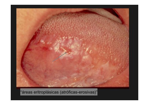 Curso Diagnóstico precoz del cáncer oral.