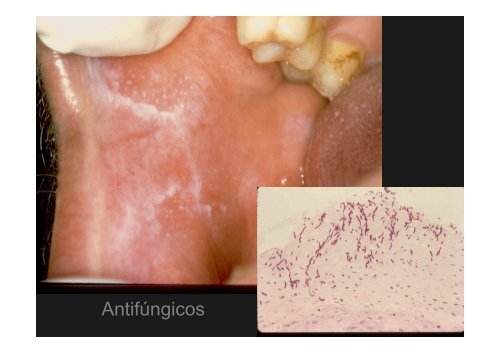 Curso Diagnóstico precoz del cáncer oral.