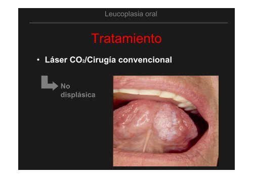 Curso Diagnóstico precoz del cáncer oral.