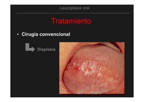 Curso Diagnóstico precoz del cáncer oral.