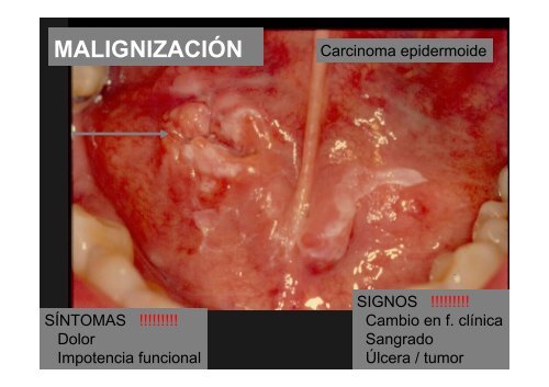 Curso Diagnóstico precoz del cáncer oral.