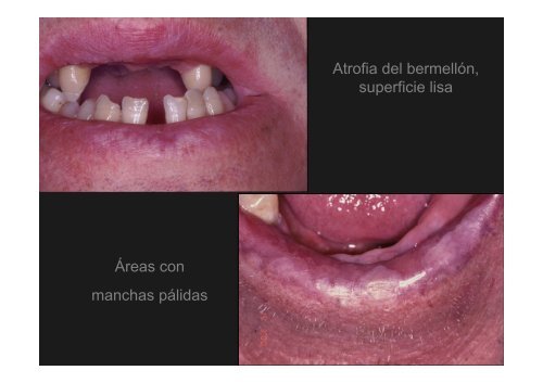 Curso Diagnóstico precoz del cáncer oral.