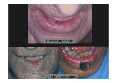 Curso Diagnóstico precoz del cáncer oral.