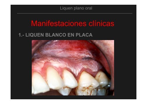 Curso Diagnóstico precoz del cáncer oral.