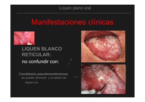 Curso Diagnóstico precoz del cáncer oral.