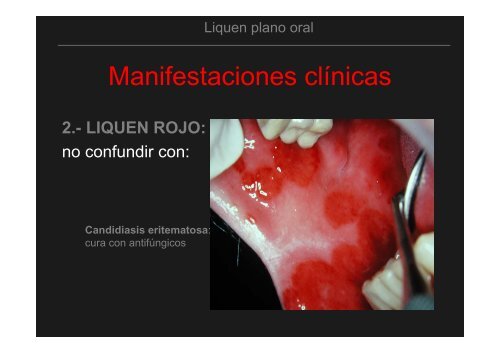 Curso Diagnóstico precoz del cáncer oral.