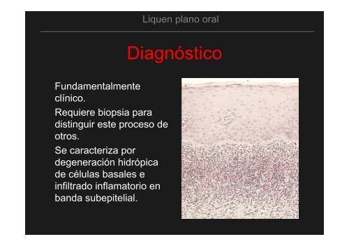 Curso Diagnóstico precoz del cáncer oral.