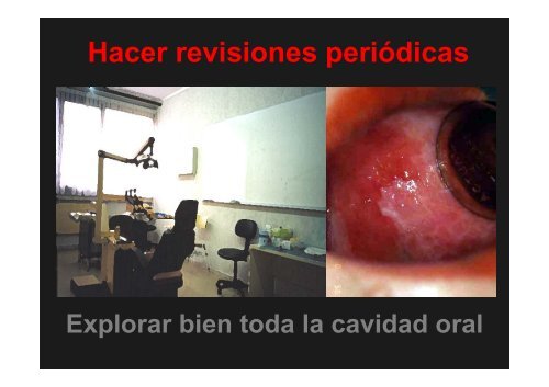 Curso Diagnóstico precoz del cáncer oral.