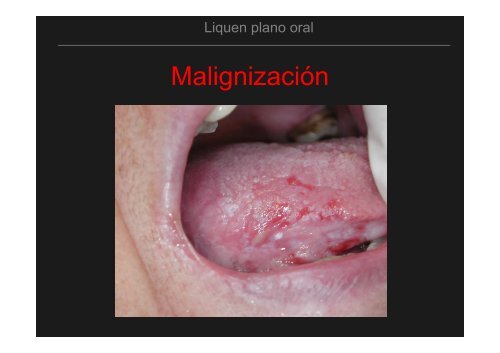 Curso Diagnóstico precoz del cáncer oral.