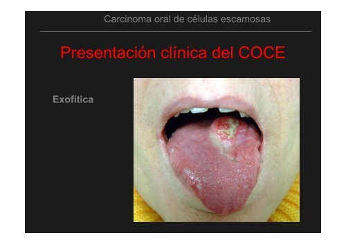 Curso Diagnóstico precoz del cáncer oral.