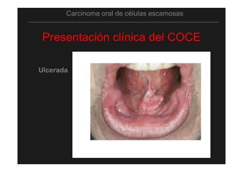 Curso Diagnóstico precoz del cáncer oral.