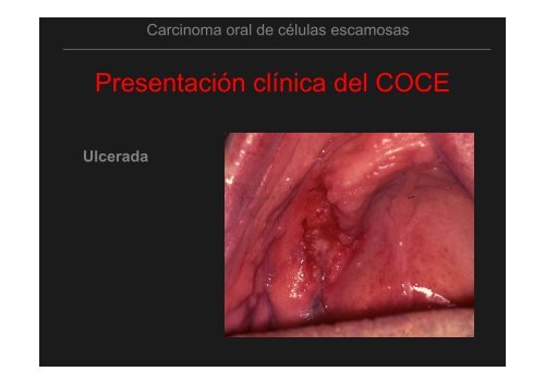 Curso Diagnóstico precoz del cáncer oral.