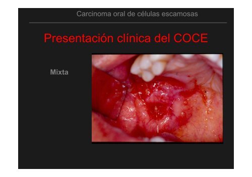 Curso Diagnóstico precoz del cáncer oral.