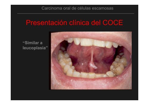 Curso Diagnóstico precoz del cáncer oral.