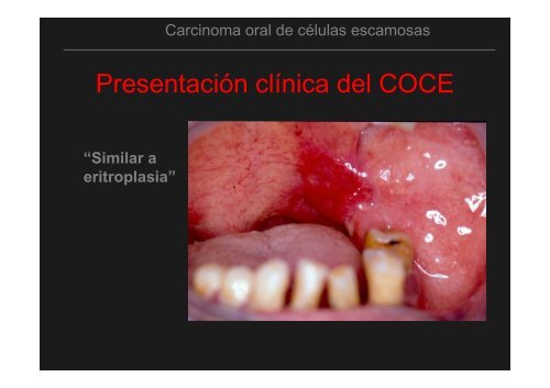 Curso Diagnóstico precoz del cáncer oral.