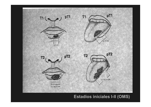 Curso Diagnóstico precoz del cáncer oral.