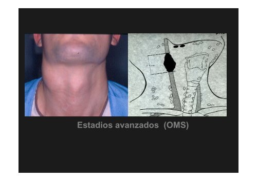 Curso Diagnóstico precoz del cáncer oral.