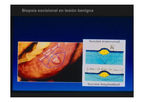 Curso Diagnóstico precoz del cáncer oral.