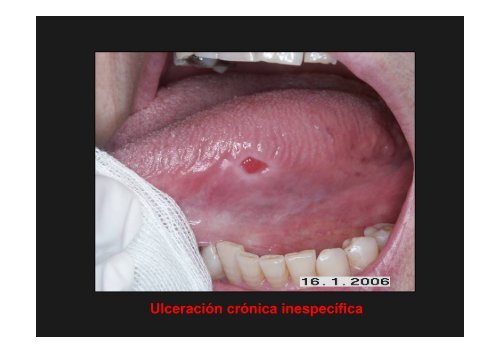 Curso Diagnóstico precoz del cáncer oral.